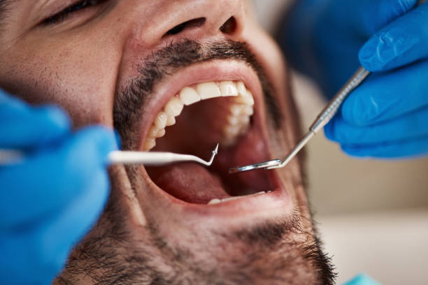 Best Walk-In Emergency Dental Services in Smithton, IL